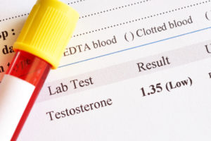 What is the Main Cause of Low Testosterone?