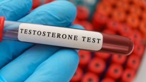 What to Expect After Low Testosterone Diagnosis