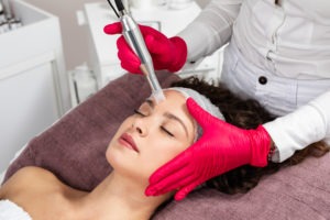 Why Celebrities Are Turning to Microneedling
